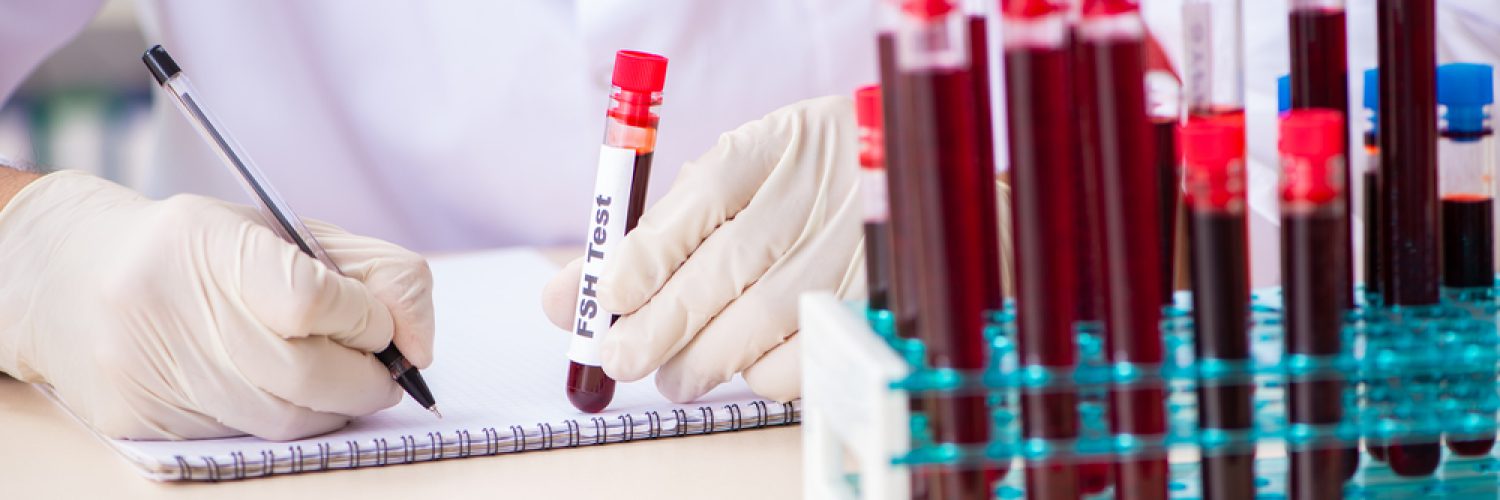 Young handsome lab assistant testing blood samples in hospital